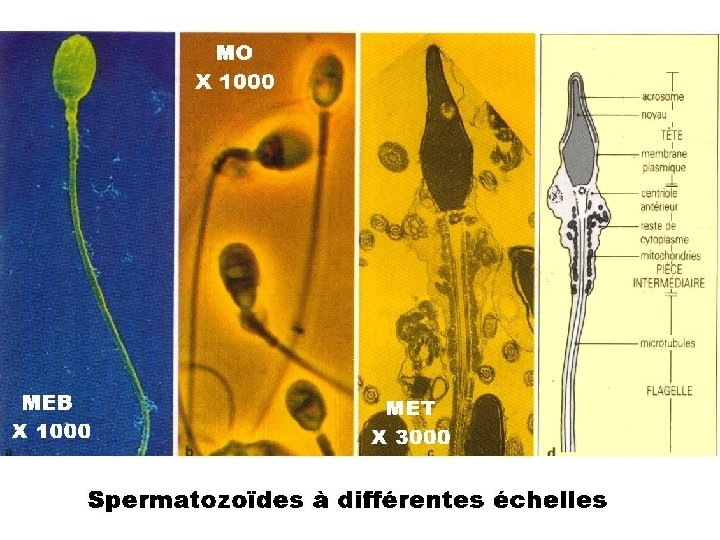 Spermatozoïde 