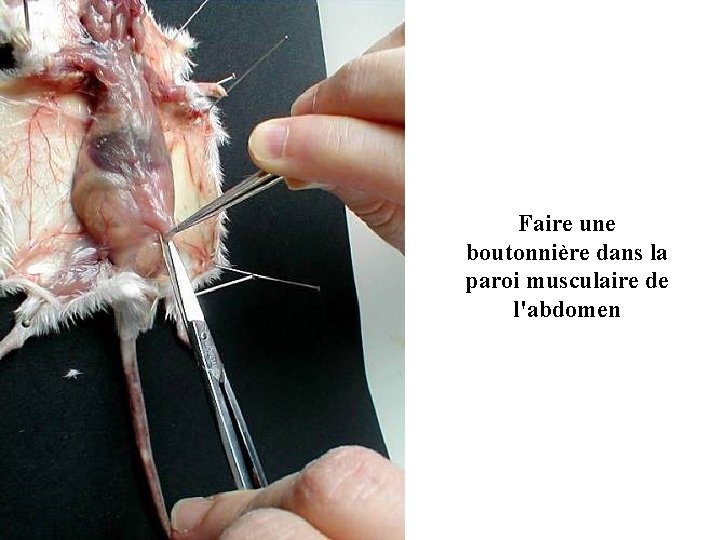 Faire une boutonnière dans la paroi musculaire de l'abdomen 