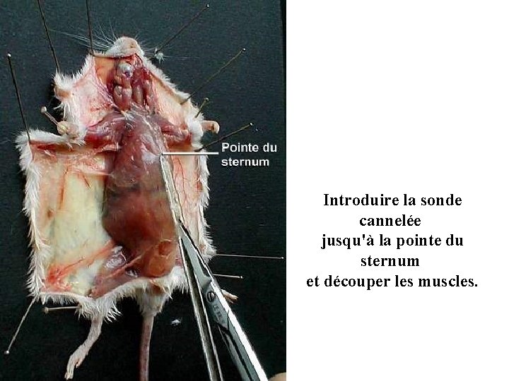 Introduire la sonde cannelée jusqu'à la pointe du sternum et découper les muscles. 