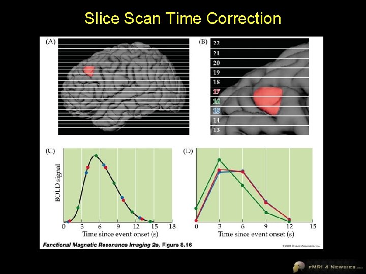 Slice Scan Time Correction 