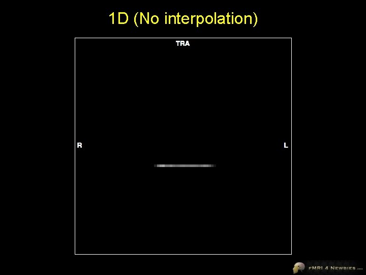 1 D (No interpolation) 
