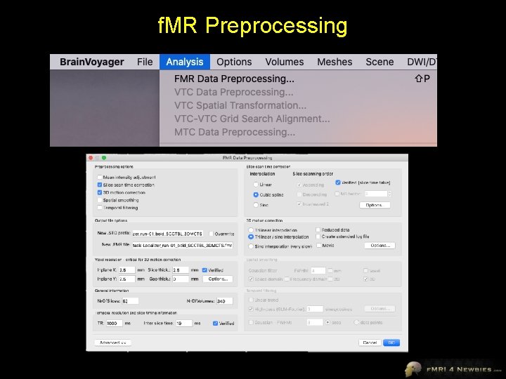 f. MR Preprocessing 