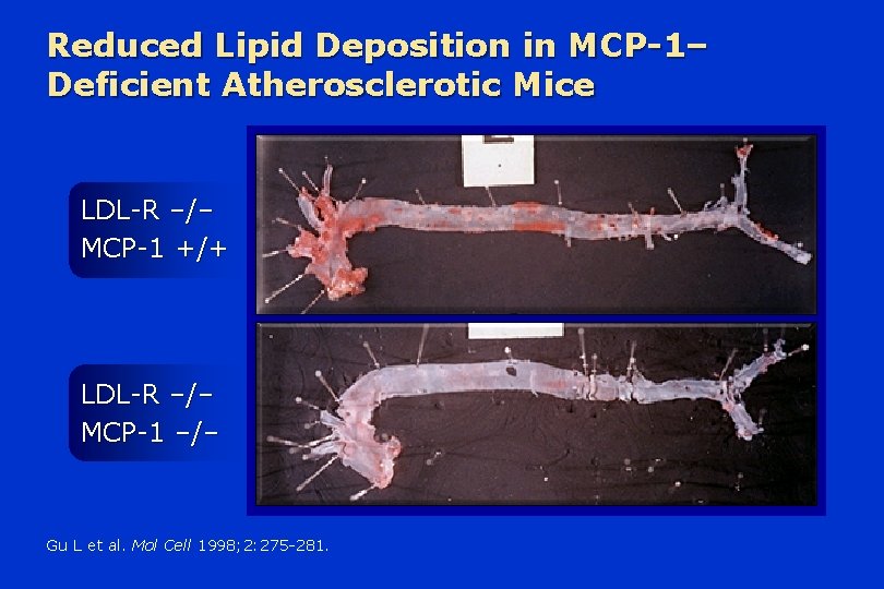 Reduced Lipid Deposition in MCP-1– Deficient Atherosclerotic Mice LDL-R –/– MCP-1 +/+ LDL-R –/–