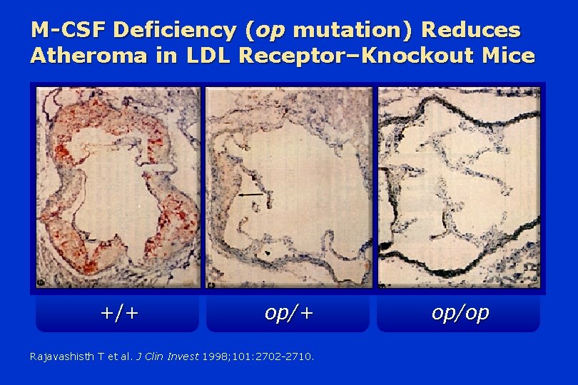 M-CSF Deficiency (op mutation) Reduces Atheroma in LDL Receptor–Knockout Mice +/+ op/+ Rajavashisth T