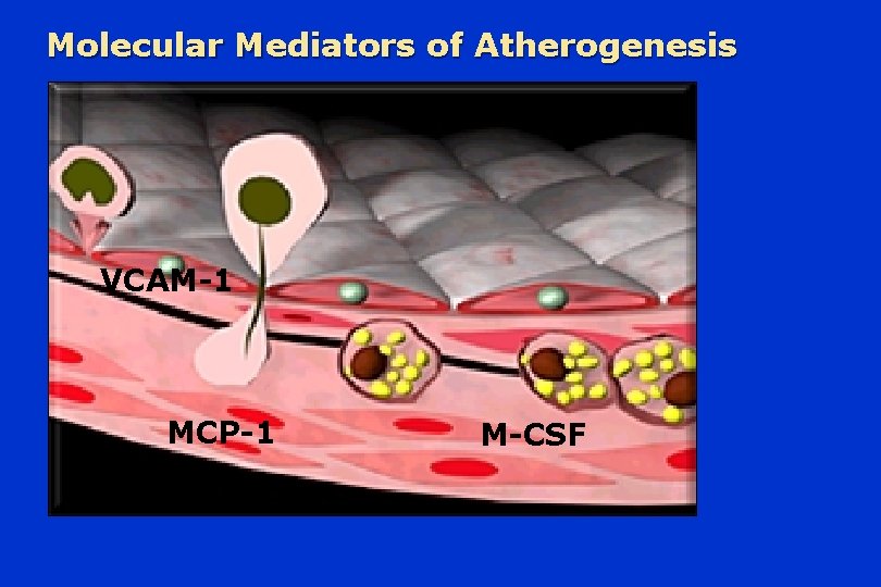 Molecular Mediators of Atherogenesis VCAM-1 MCP-1 M-CSF 