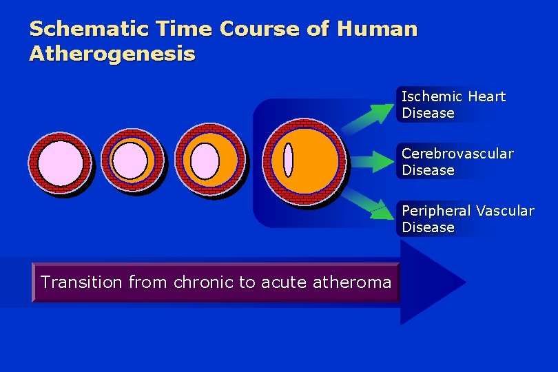 Schematic Time Course of Human Atherogenesis Ischemic Heart Disease Cerebrovascular Disease Peripheral Vascular Disease