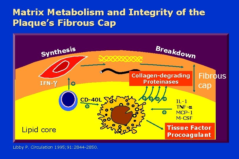 Matrix Metabolism and Integrity of the Plaque’s Fibrous Cap Brea is s e h