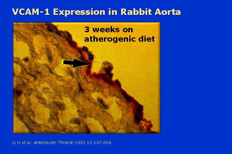 VCAM-1 Expression in Rabbit Aorta 3 weeks on atherogenic diet Li H et al.