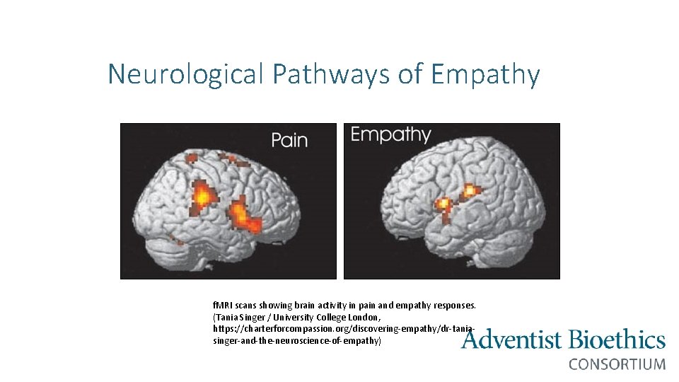 Neurological Pathways of Empathy f. MRI scans showing brain activity in pain and empathy