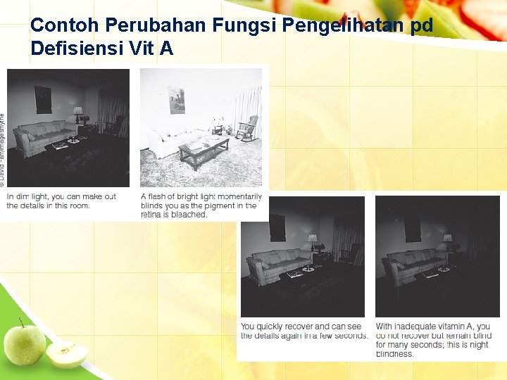 Contoh Perubahan Fungsi Pengelihatan pd Defisiensi Vit A 