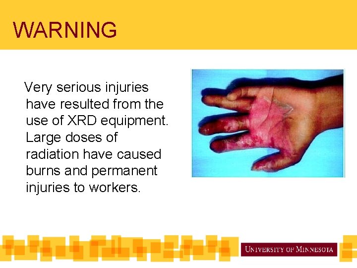WARNING Very serious injuries have resulted from the use of XRD equipment. Large doses WARNING Very serious injuries have resulted from the use of XRD equipment. Large doses