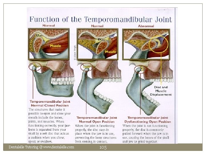 Dentalelle Tutoring @ www. dentalelle. com 105 