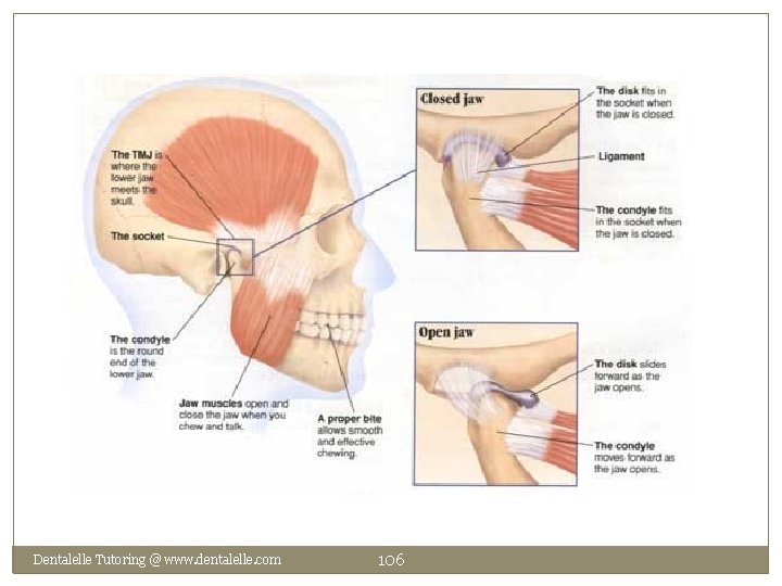 Dentalelle Tutoring @ www. dentalelle. com 106 