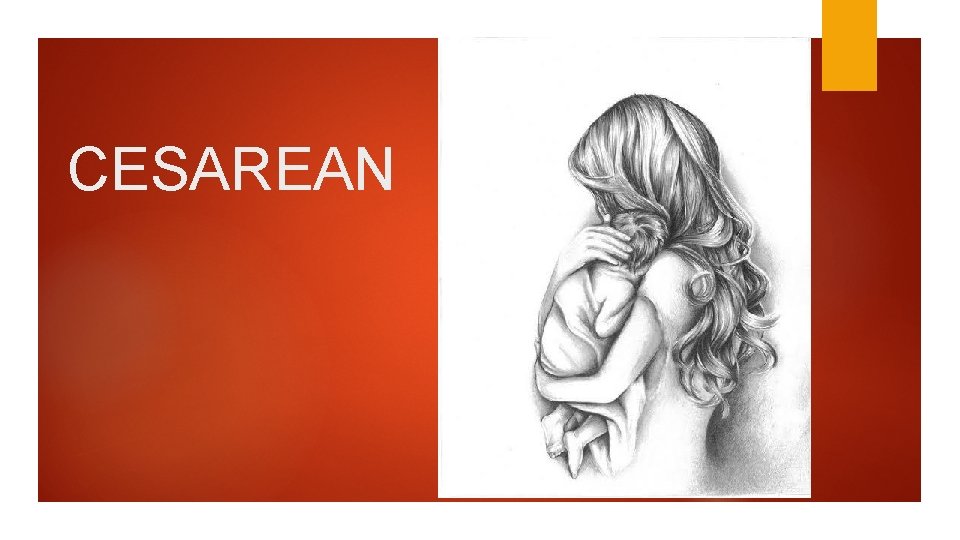 CESAREAN 