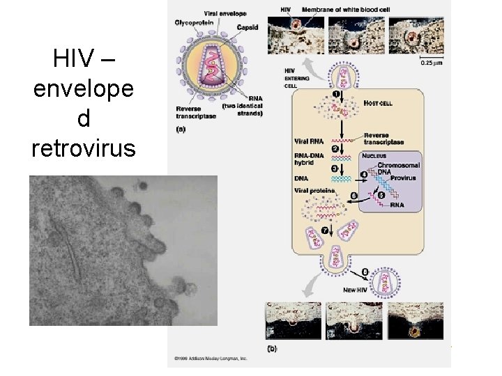 HIV – envelope d retrovirus 