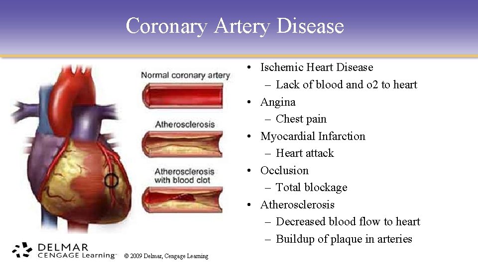 Coronary Artery Disease • Ischemic Heart Disease – Lack of blood and o 2