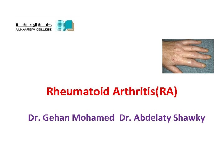 Rheumatoid Arthritis(RA) Dr. Gehan Mohamed Dr. Abdelaty Shawky 