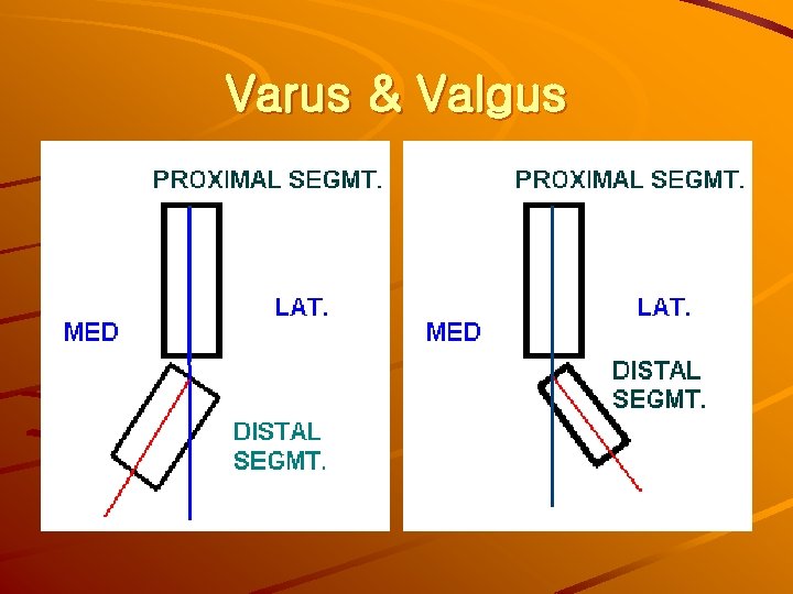 Varus & Valgus 