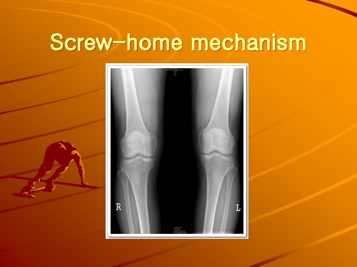 Screw-home mechanism 
