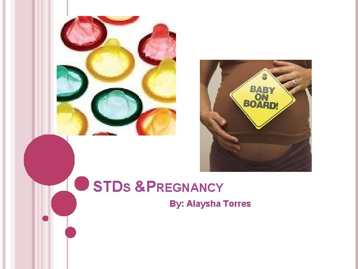 STDS &PREGNANCY By: Alaysha Torres 