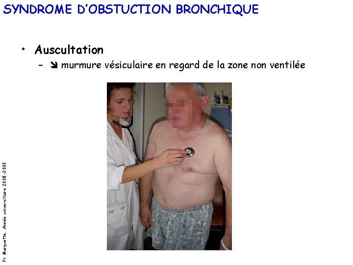 SYNDROME D’OBSTUCTION BRONCHIQUE • Auscultation Pr Marquette. Année universitaire 2008 -2009 – murmure vésiculaire