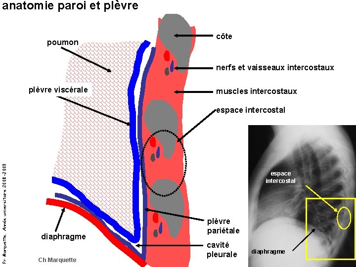 anatomie paroi et plèvre poumon côte nerfs et vaisseaux intercostaux plèvre viscérale muscles intercostaux