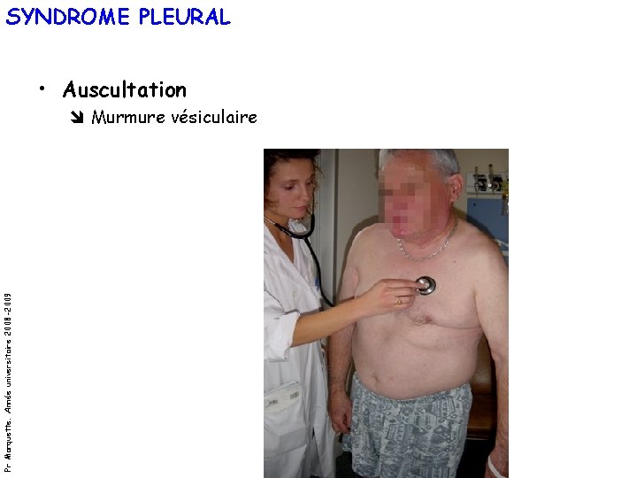 SYNDROME PLEURAL • Auscultation Pr Marquette. Année universitaire 2008 -2009 Murmure vésiculaire 