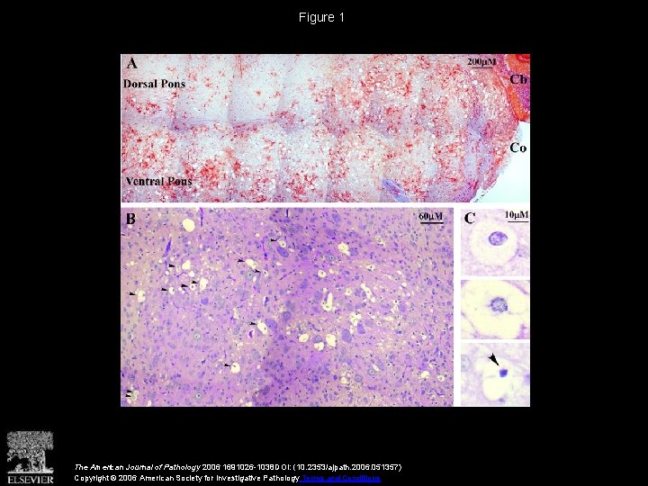 Figure 1 The American Journal of Pathology 2006 1691026 -1038 DOI: (10. 2353/ajpath. 2006.