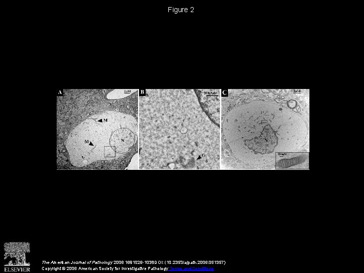 Figure 2 The American Journal of Pathology 2006 1691026 -1038 DOI: (10. 2353/ajpath. 2006.