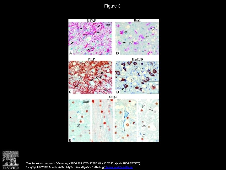 Figure 3 The American Journal of Pathology 2006 1691026 -1038 DOI: (10. 2353/ajpath. 2006.