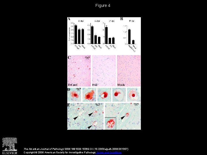 Figure 4 The American Journal of Pathology 2006 1691026 -1038 DOI: (10. 2353/ajpath. 2006.