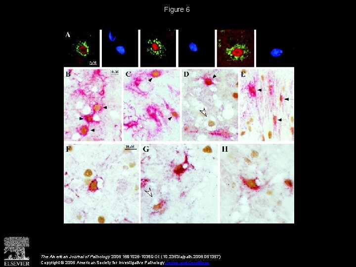Figure 6 The American Journal of Pathology 2006 1691026 -1038 DOI: (10. 2353/ajpath. 2006.