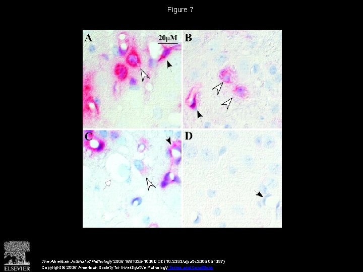 Figure 7 The American Journal of Pathology 2006 1691026 -1038 DOI: (10. 2353/ajpath. 2006.