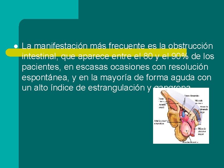 l La manifestación más frecuente es la obstrucción intestinal, que aparece entre el 80