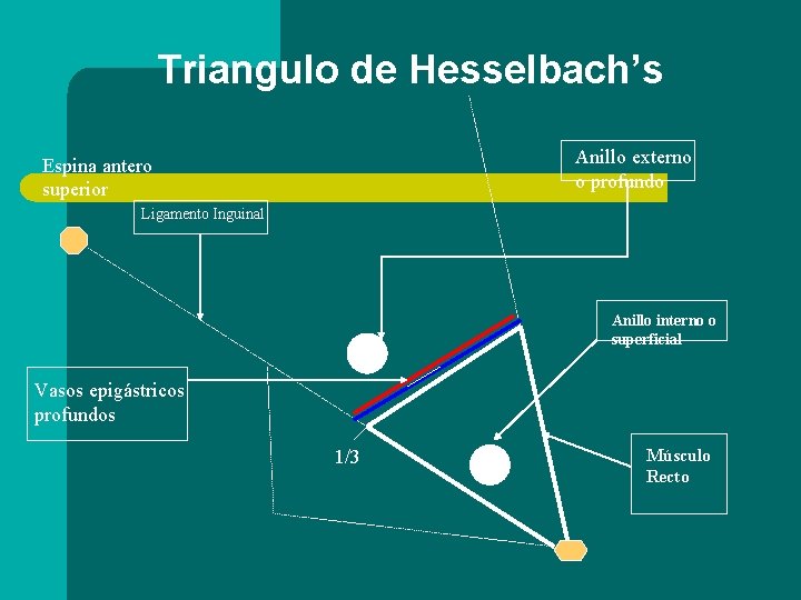 Triangulo de Hesselbach’s Anillo externo o profundo Espina antero superior Ligamento Inguinal Anillo interno
