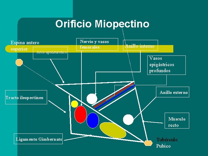 Orificio Miopectino Espina antero superior Nervio y vasos femorales Anillo interno Arco aponeurotico Vasos