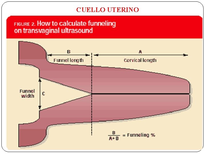 CUELLO UTERINO 