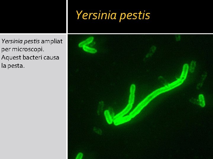Yersinia pestis ampliat per microscopi. Aquest bacteri causa la pesta. 
