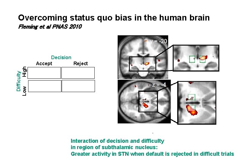 Overcoming status quo bias in the human brain Fleming et al PNAS 2010 Difficulty