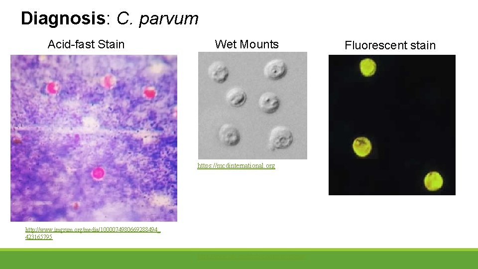 Diagnosis: C. parvum Acid-fast Stain Wet Mounts https: //mcdinternational. org http: //www. imgrum. org/media/1000074980669288494_