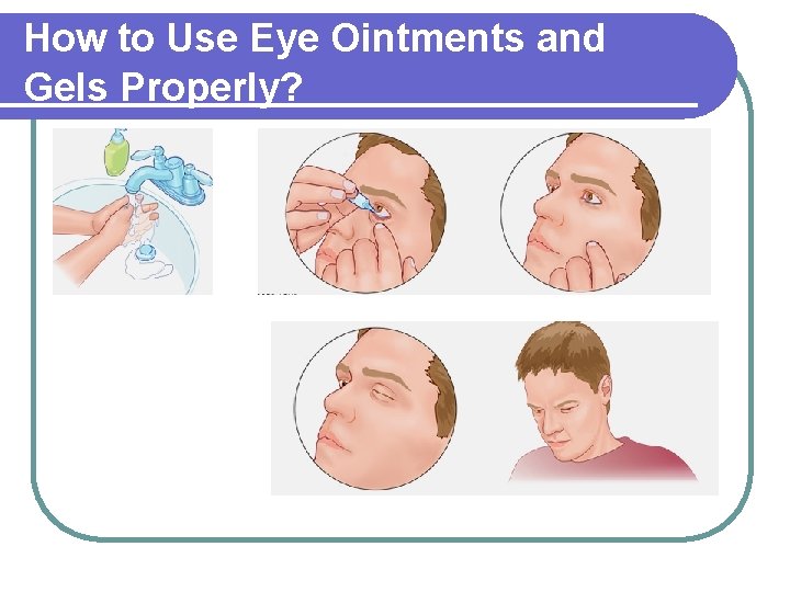 How to Use Eye Ointments and Gels Properly? 