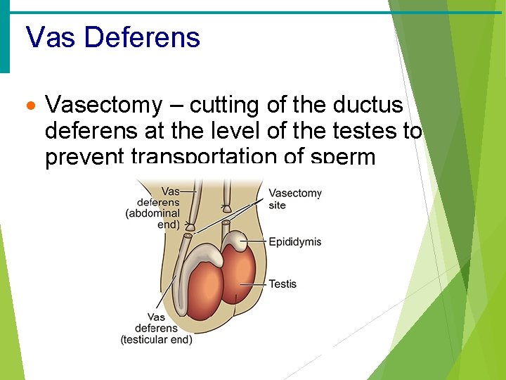 Vas Deferens · Vasectomy – cutting of the ductus deferens at the level of