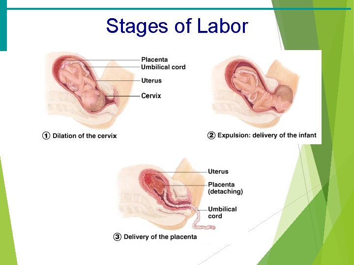 Stages of Labor 
