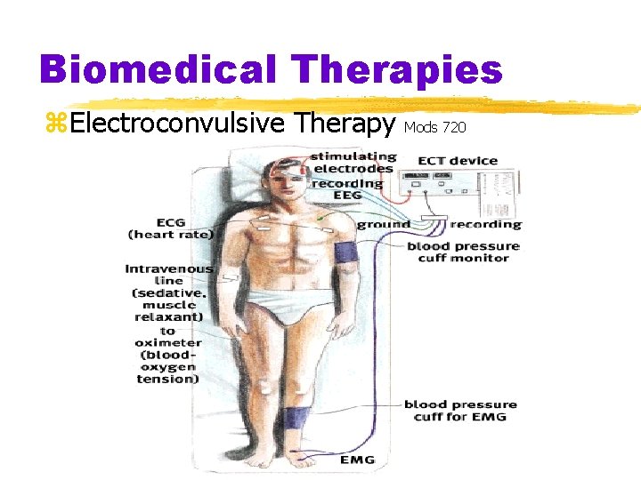 Biomedical Therapies z. Electroconvulsive Therapy Mods 720 