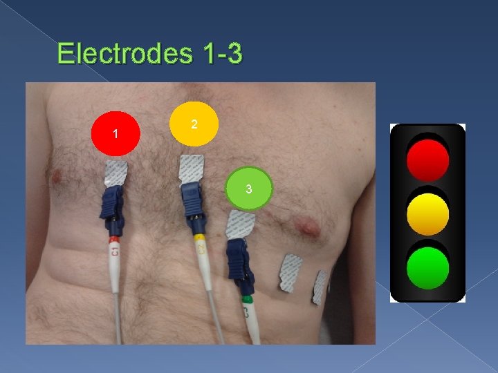 Electrodes 1 -3 1 2 3 