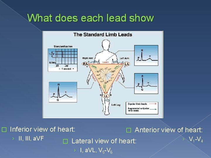 What does each lead show � Inferior view of heart: › II, III, a.