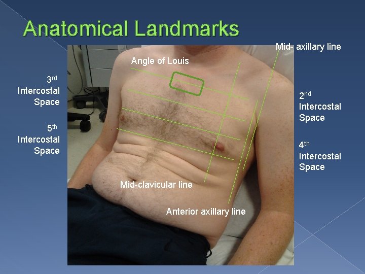 Anatomical Landmarks Mid- axillary line Angle of Louis 3 rd Intercostal Space 2 nd