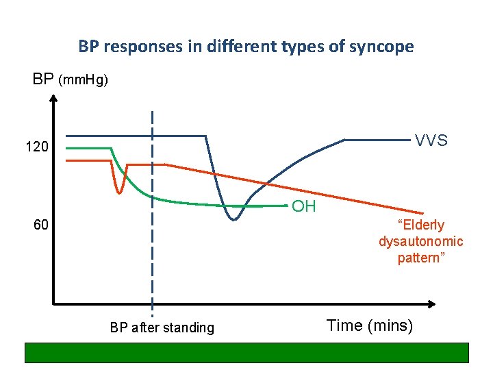 BP responses in different types of syncope BP (mm. Hg) VVS 120 OH 60