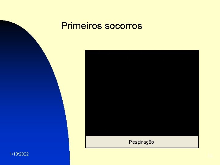 Primeiros socorros 1/13/2022 14 