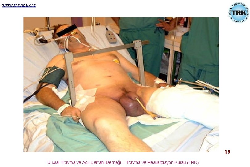 www. travma. org 19 Ulusal Travma ve Acil Cerrahi Derneği – Travma ve Resüsitasyon